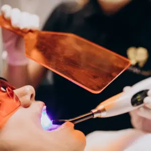 Kosmetische Zahnaufhellung